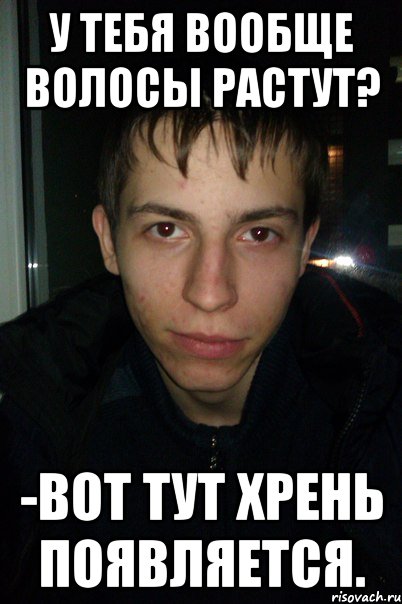 У тебя вообще волосы растут? -Вот тут хрень появляется.