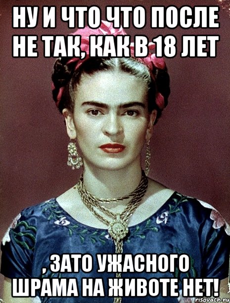 Ну и что что после не так, как в 18 лет , зато УЖАСНОГО ШРАМА на животе нет!