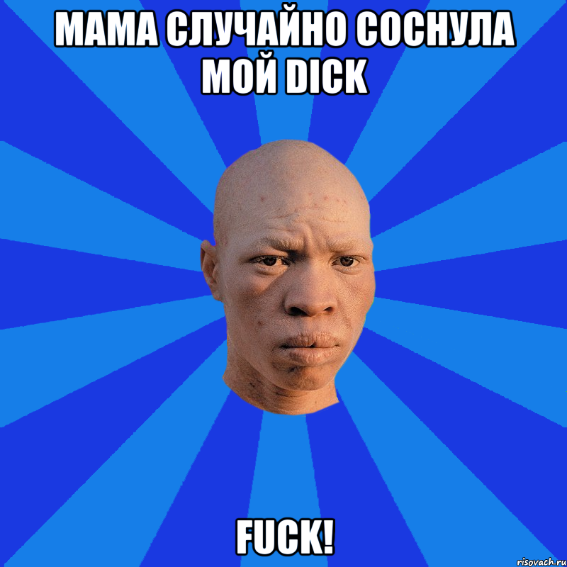 Мама случайно соснула мой Dick FUCK!, Мем НЕДОВОЛЬНЫЙ АЛЬБИНОС