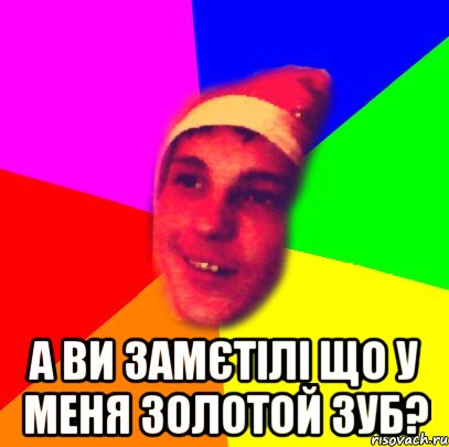  а ви замєтілі що у меня золотой зуб?