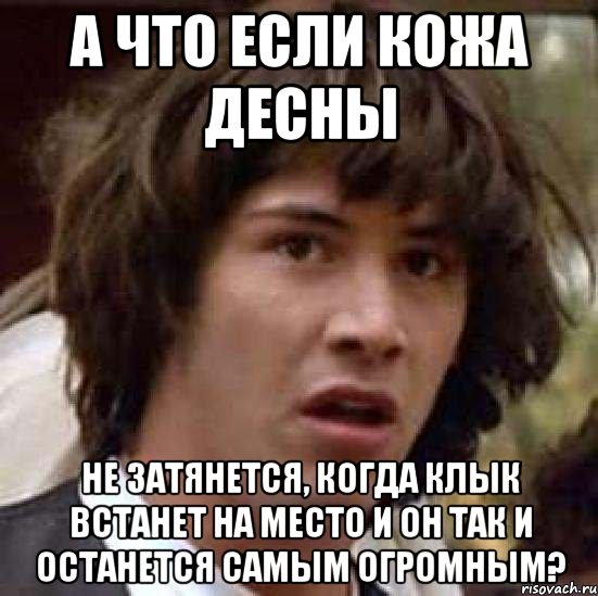 а что если кожа десны не затянется, когда клык встанет на место и он так и останется самым огромным?, Мем А что если (Киану Ривз)