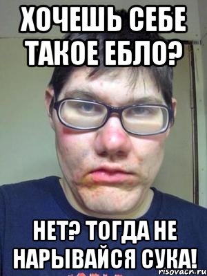 Хочешь себе такое ебло? Нет? Тогда не нарывайся сука!, Мем красавчик