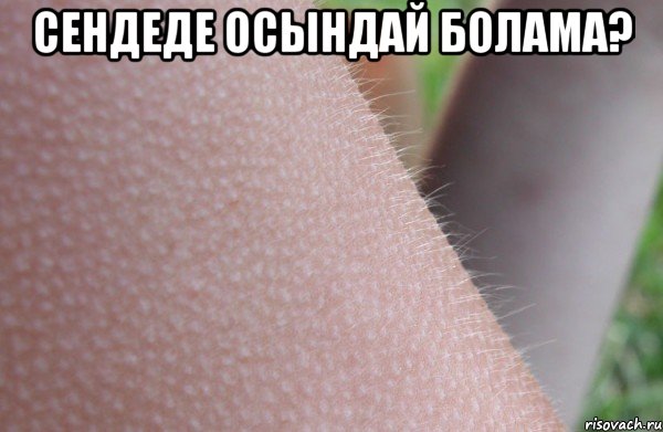 Сендеде осындай болама? 