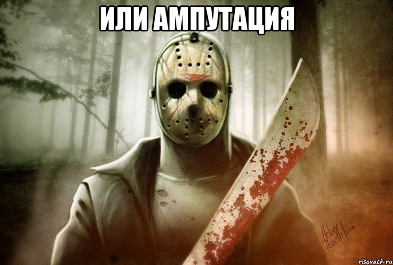или ампутация 
