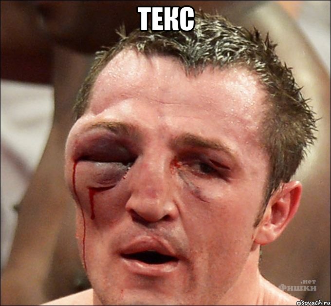 текс , Мем фингал