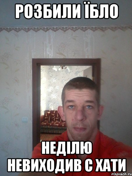 розбили їбло неділю невиходив с хати