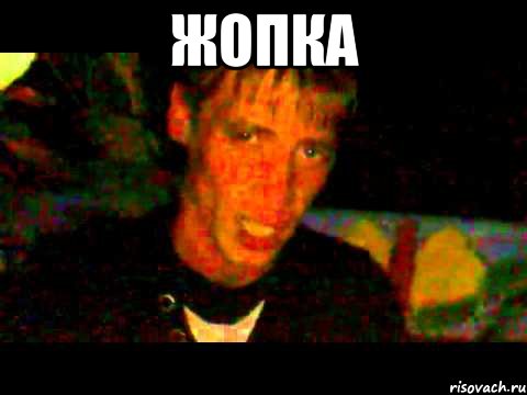 Жопка 