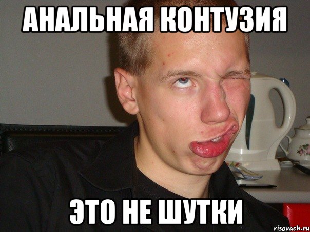 АНАЛЬНАЯ КОНТУЗИЯ ЭТО НЕ ШУТКИ