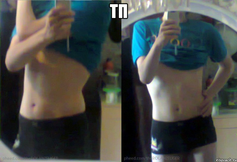 тп 