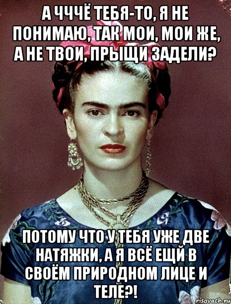 А чччё тебя-то, я не понимаю, так мои, мои же, а не твои, прыщи задели? Потому что у тебя уже две натяжки, а я всё ещй в своём природном лице и теле?!