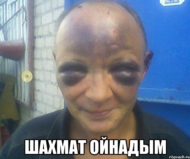  шахмат ойнадым, Мем человек синяк