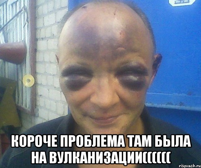  Короче проблема там была на вулканизации((((((, Мем человек синяк