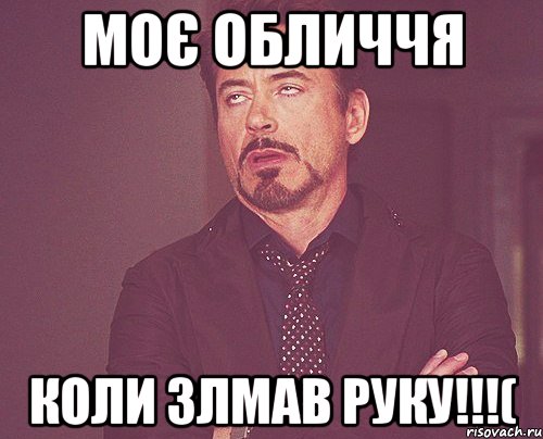 моє обличчя коли злмав руку!!!(, Мем твое выражение лица