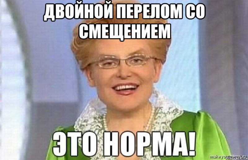 ДВОЙНОЙ ПЕРЕЛОМ СО СМЕЩЕНИЕМ 