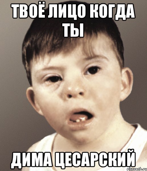 твоё лицо когда ты дима цесарский