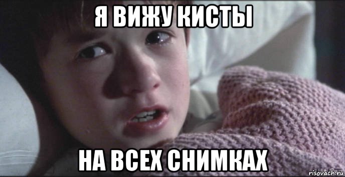 я вижу кисты на всех снимках