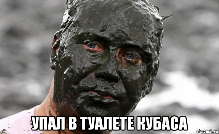  упал в туалете кубаса