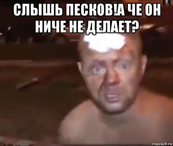 слышь песков!а че он ниче не делает? 