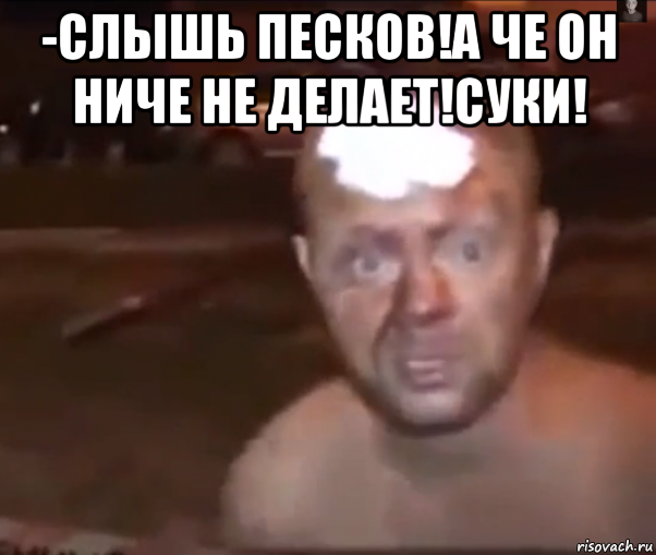 -слышь песков!а че он ниче не делает!суки! 