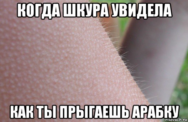 когда шкура увидела как ты прыгаешь арабку