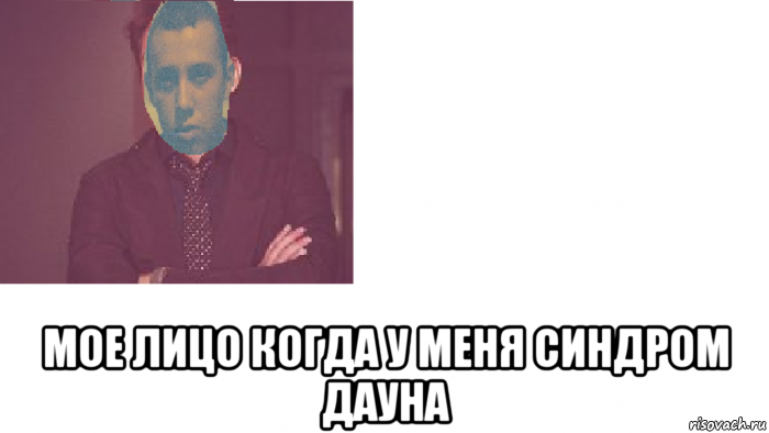  мое лицо когда у меня синдром дауна, Мем 111