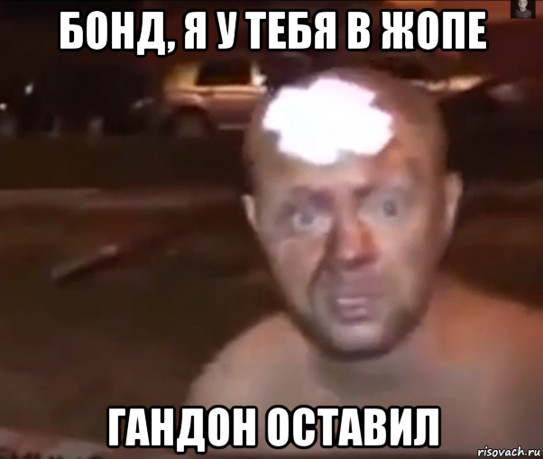 бонд, я у тебя в жопе гандон оставил
