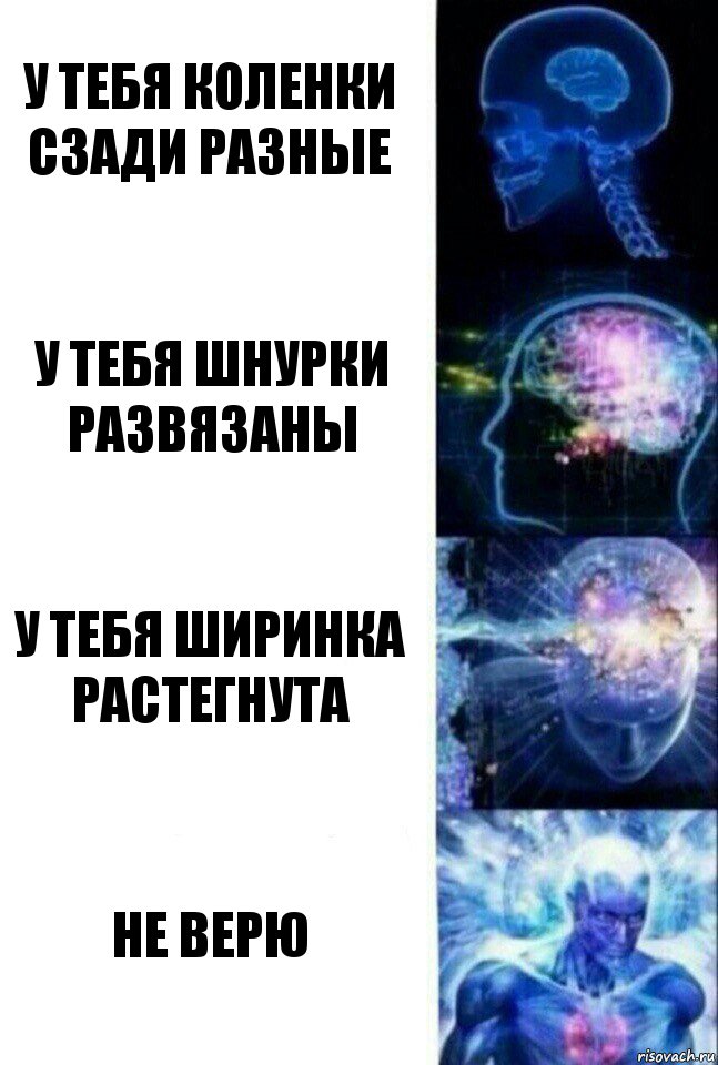 у тебя коленки сзади разные у тебя шнурки развязаны у тебя ширинка растегнута НЕ ВЕРЮ, Комикс  Сверхразум