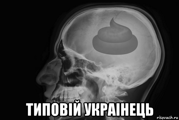  типовiй украiнець
