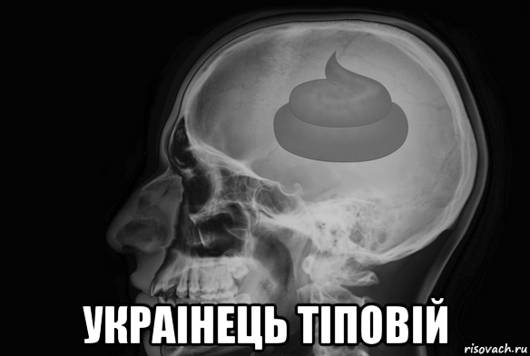  украiнець тiповiй