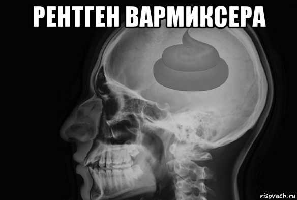 рентген вармиксера 