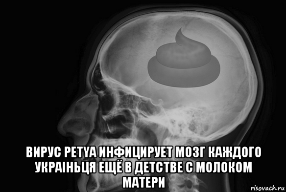  вирус petya инфицирует мозг каждого украiньця ещё в детстве с молоком матери