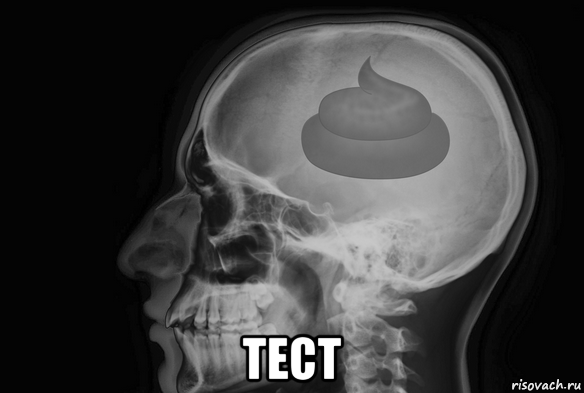  тест
