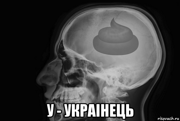  у - украiнець