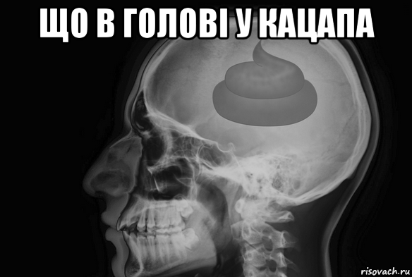 що в голові у кацапа 