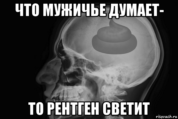 что мужичье думает- то рентген светит