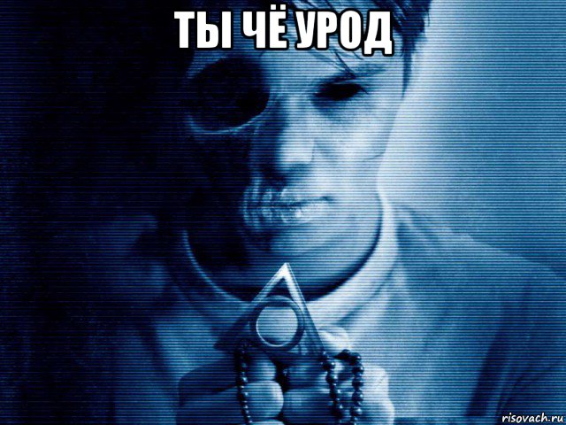 ты чё урод 