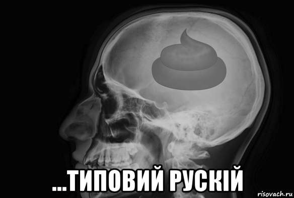  ...типовий рускій