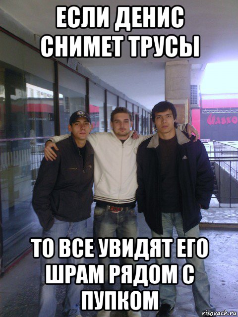 если денис снимет трусы то все увидят его шрам рядом с пупком