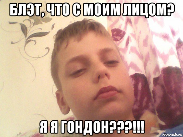 блэт, что с моим лицом? я я гондон???!!!