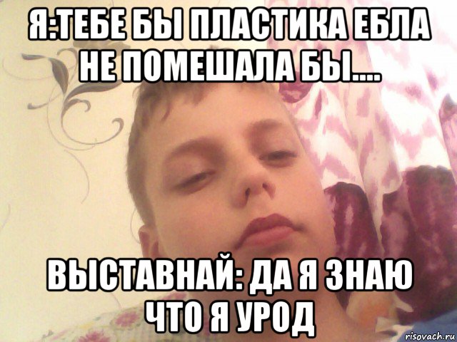 я:тебе бы пластика ебла не помешала бы.... выставнай: да я знаю что я урод