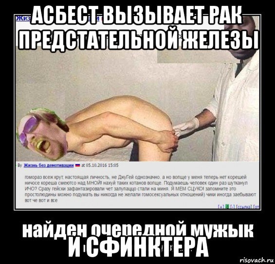 асбест вызывает рак предстательной железы и сфинктера