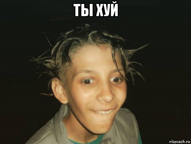 ты хуй 