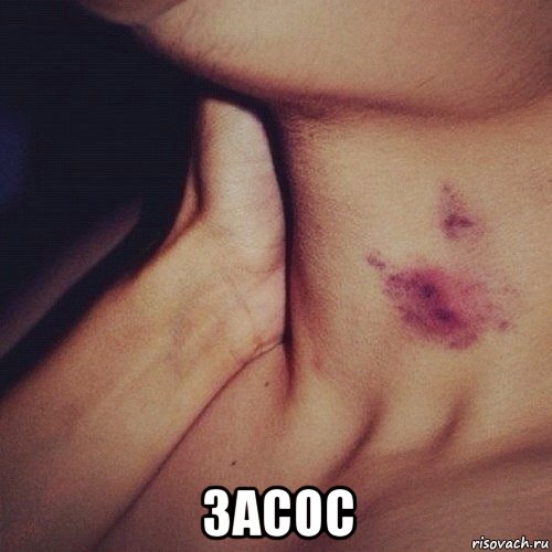  засос, Мем Засос