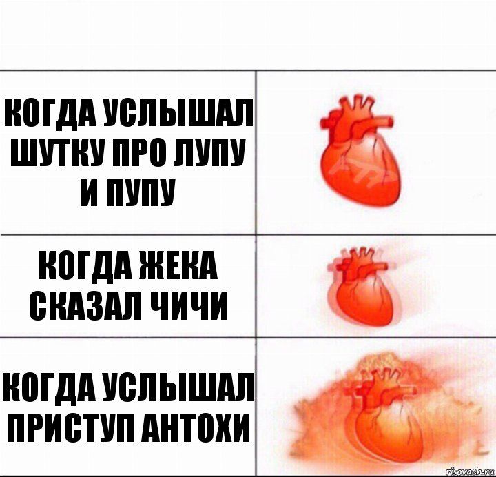 Когда услышал шутку про лупу и пупу Когда Жека сказал чичи Когда услышал приступ антохи, Комикс  Расширяюшее сердце