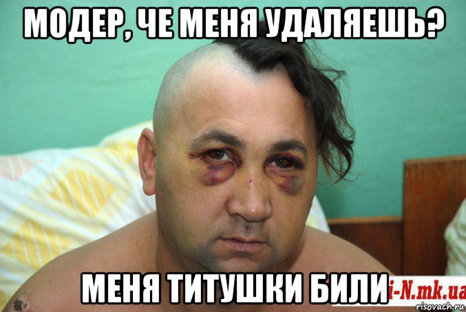 модер, че меня удаляешь? меня титушки били