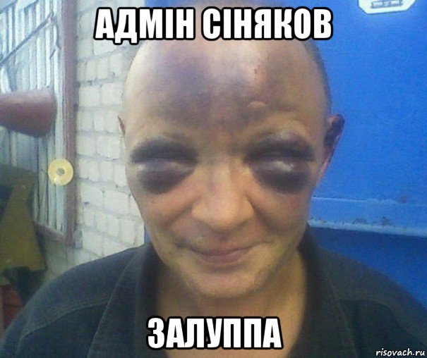адмін сіняков залуппа, Мем человек синяк