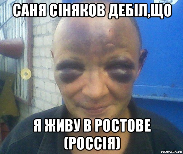саня сіняков дебіл,що я живу в ростове (россія)