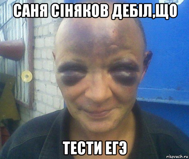 саня сіняков дебіл,що тести егэ