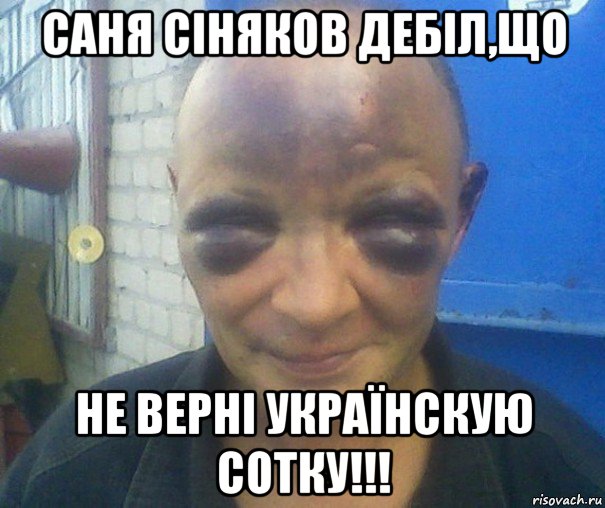 саня сіняков дебіл,що не верні українскую сотку!!!