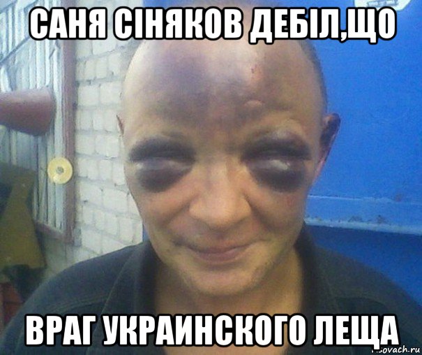саня сіняков дебіл,що враг украинского леща